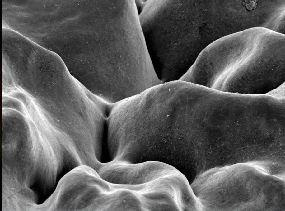 Fissurenversiegelung: Fissurentiefe und stark zerklüftete Zahnoberfläche (© PD Dr. Jan Kühnisch)